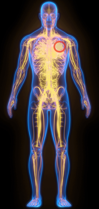 Human body icon outlining an example of the effects of non–tumor selective immunotherapies for a person with lung cancer